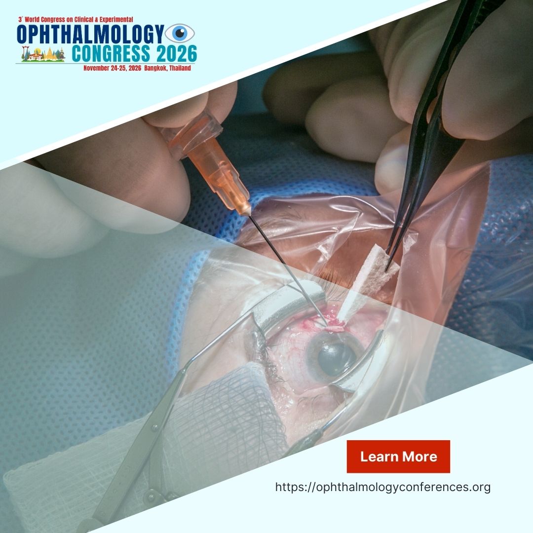 Cataracts – Causes, Symptoms, and Modern Treatment Options